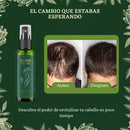 ¡Compra 2 Sprays para el Crecimiento del Cabello y recibe 3 + un perfume de feromonas gratis!
