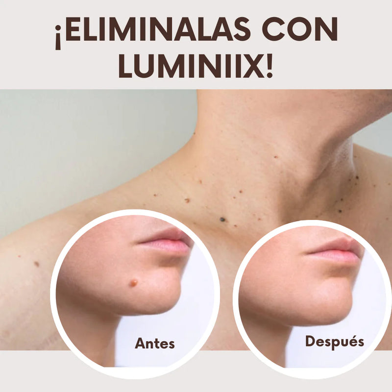 “Llévate el tratamiento completo: elimina las verrugas y aclara tu piel. Compra un eliminador de verrugas y recibe gratis un aclarador de piel.”