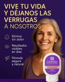 “Llévate el tratamiento completo: elimina las verrugas y aclara tu piel. Compra un eliminador de verrugas y recibe gratis un aclarador de piel.”